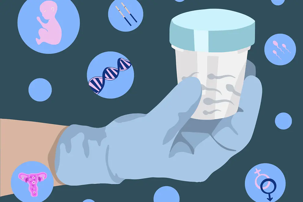 Eine Hand hält einen Becher mit Samenspende