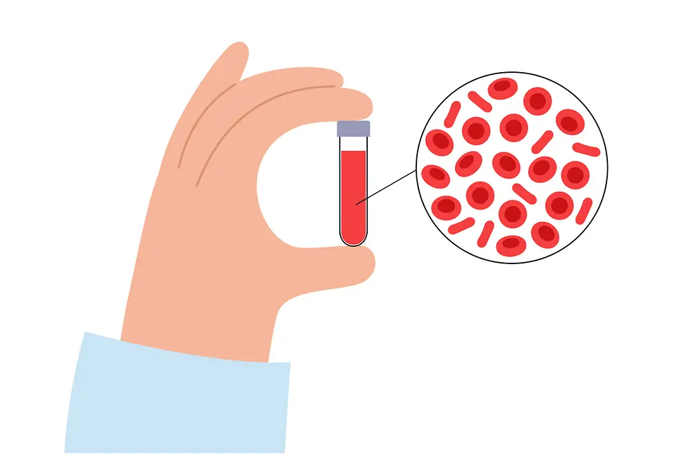 Eine Hand hält ein Reagenzglas mit Blut, das vergrößert wird