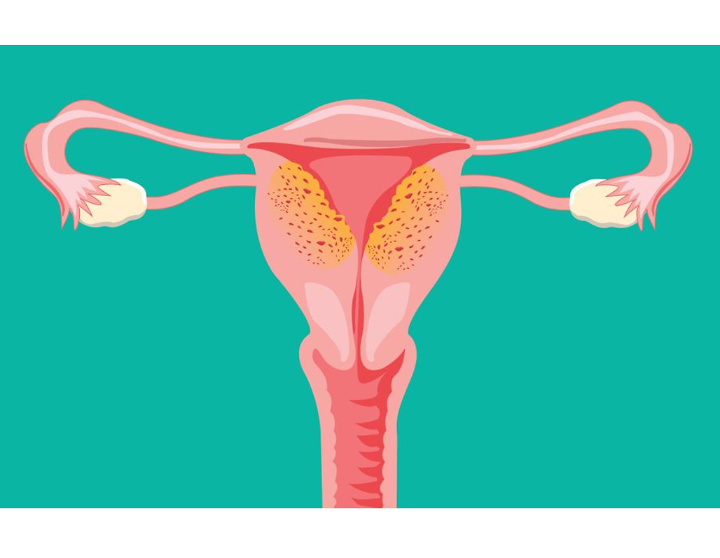 Abbildung der Eierstöcke