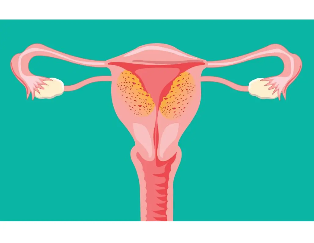 Abbildung der Eierstöcke